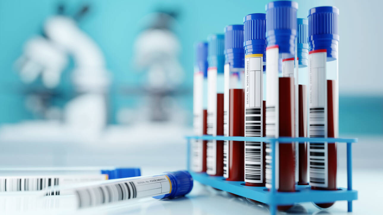 การเตรียมตัวของคุณผู้ชายก่อนเข้ารับการตรวจวิเคราะห์อสุจิ (Semen Analysis) ที่ GFC Clinic