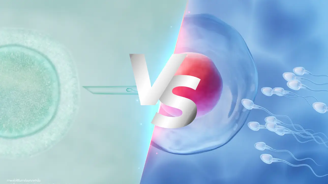 ความแตกต่างระหว่างเด็กหลอดแก้ว (IVF) และเด็กเกิดธรรมชาติ พร้อมข้อดีของการรักษาที่ GFC Clinic | IVF vs Natural Conception Bangkok